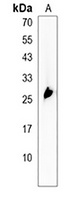 GAGE12B Rabbit Polyclonal Antibody