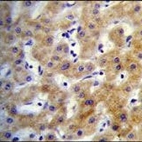 Anti-KRTCAP2 Antibody