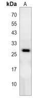 RPEL1 Rabbit Polyclonal Antibody