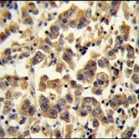 TTC39B Antibody
