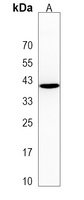 C17orf59 Rabbit Polyclonal Antibody