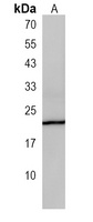 C16orf13 Rabbit Polyclonal Antibody