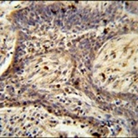 Anti-PPRC1 Antibody