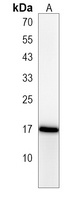 NDUFAF3 Antibody