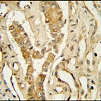 NDUFAF3 Antibody