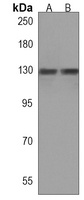 BCL11B Rabbit Polyclonal Antibody