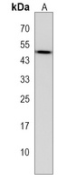 ERCC8 Rabbit Polyclonal Antibody