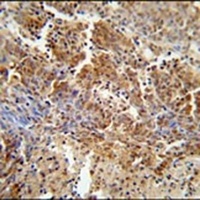 Anti-ERCC8 Antibody