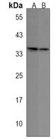 OR6C4 Rabbit Polyclonal Antibody