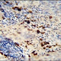 Anti-LCE1A Antibody