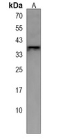 OR8B8 Rabbit Polyclonal Antibody