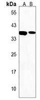 CCDC122 Antibody