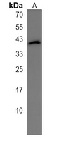 SLFNL1 Rabbit Polyclonal Antibody