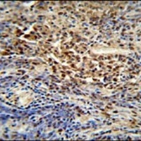 Anti-PUS3 Antibody