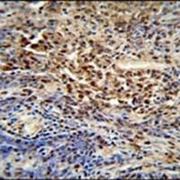 Anti-PUS3 Antibody