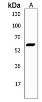 DPEP3 Rabbit Polyclonal Antibody