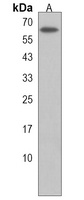 CR1L Rabbit Polyclonal Antibody