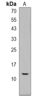 SPRR2A Rabbit Polyclonal Antibody