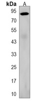 ZNF366 Rabbit Polyclonal Antibody
