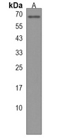 ESCO2 Rabbit Polyclonal Antibody