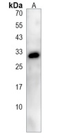 CES1P1 Rabbit Polyclonal Antibody
