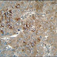 CES1P1 Rabbit Polyclonal Antibody