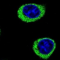 Anti-AMY2B Antibody