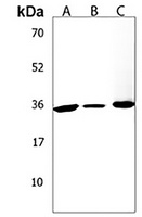 BCKDHB Antibody