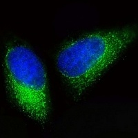 Anti-BCKDHB Antibody