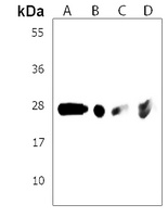 ARV1 Rabbit Polyclonal Antibody