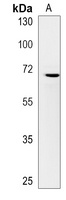 CCDC37 Rabbit Polyclonal Antibody