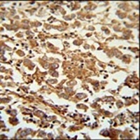 Anti-SPATC1 Antibody