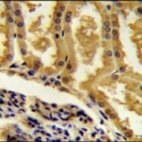Anti-CRIP3 Antibody