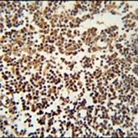 Anti-GTSF1 Antibody