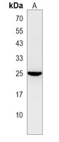 NUDT8 Antibody