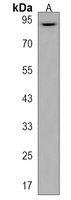 ZBTB41 Rabbit Polyclonal Antibody