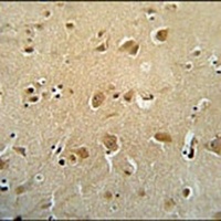 WWC3 Rabbit Polyclonal Antibody