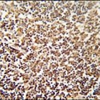 Anti-ZNF98 Antibody