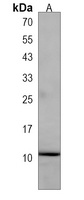 NDUFA11 Rabbit Polyclonal Antibody