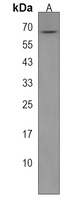 ST7 Rabbit Polyclonal Antibody