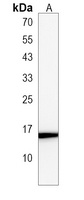 ATP6V0B Rabbit Polyclonal Antibody