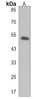 DENND1B Antibody