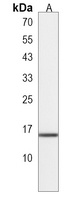 NAT14 Antibody