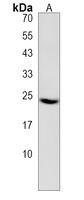 Claudin 22 Rabbit Polyclonal Antibody