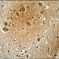 Anti-Hevin Antibody