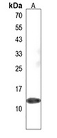 UBA52 Rabbit Polyclonal Antibody