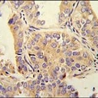 UBA52 Rabbit Polyclonal Antibody