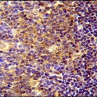 BLOC1S5 Antibody