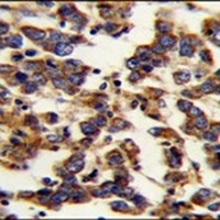 Anti-BSCL2 Antibody