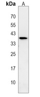 LGALS9B Antibody